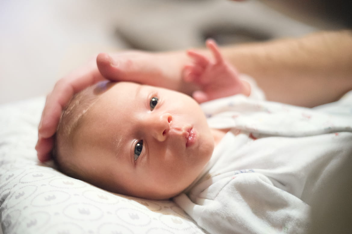 Qué es la costra láctea del bebé y cómo se quita? - Entre Tartas y